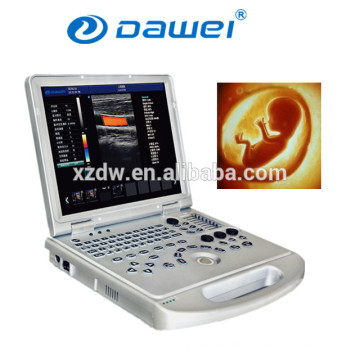 laptop ultrasound color doppler & color ultrasound laptop price